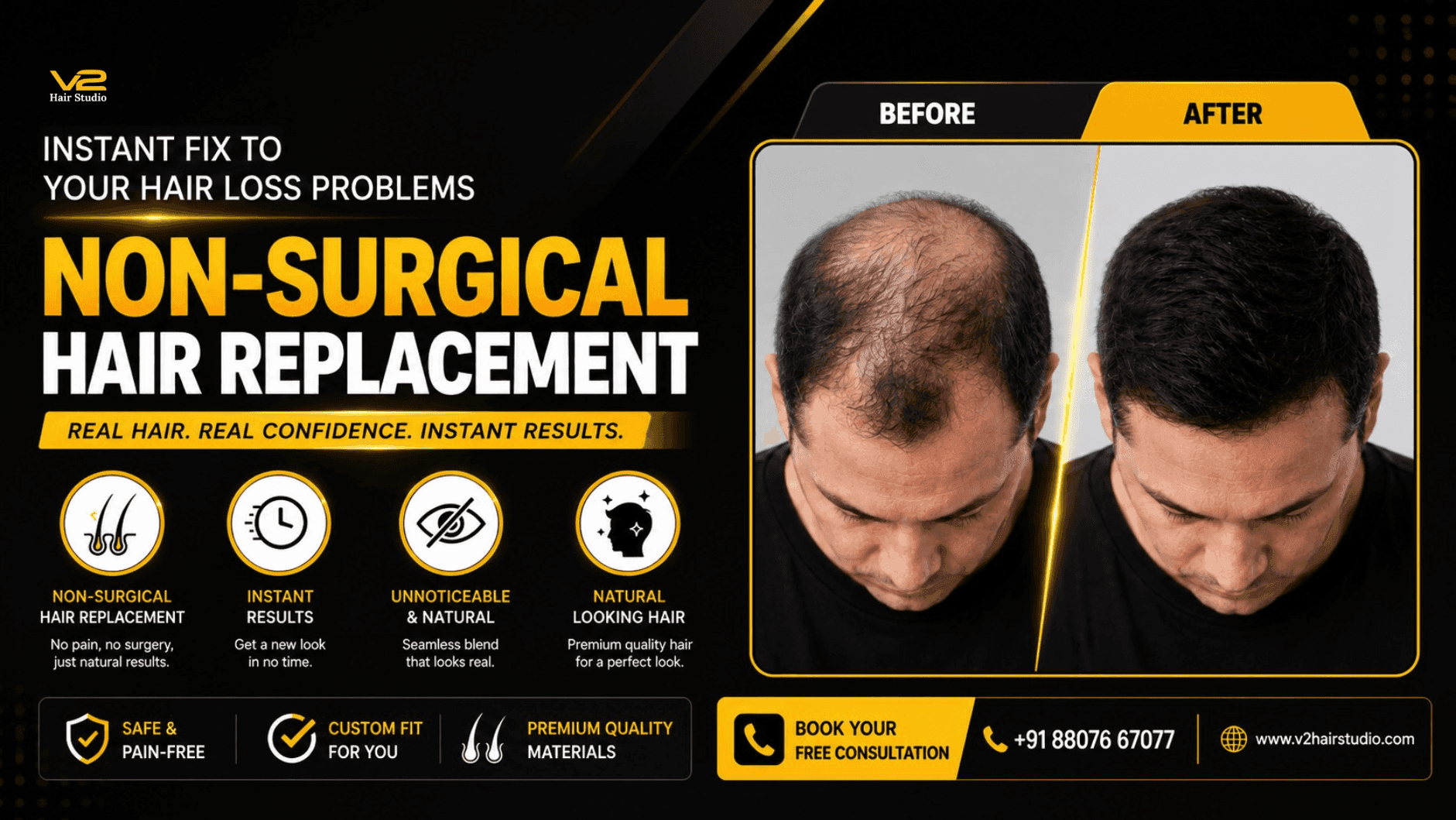 Chennai's Premium Hair Studio 1
